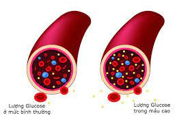 Xét nghiệm Hemoglobin là gì? Có ý nghĩa như thế nào?