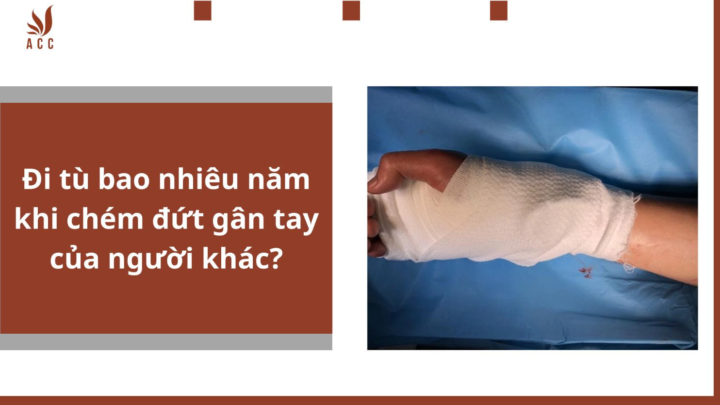Đi tù bao nhiêu năm khi chém đứt gân tay của người khác?