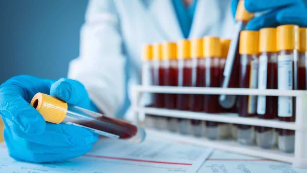 Mẫu hợp đồng cung cấp dịch vụ xét nghiệm mới nhất năm 2023