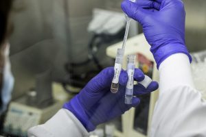 Xét Nghiệm Covid19 Gộp Là Gì